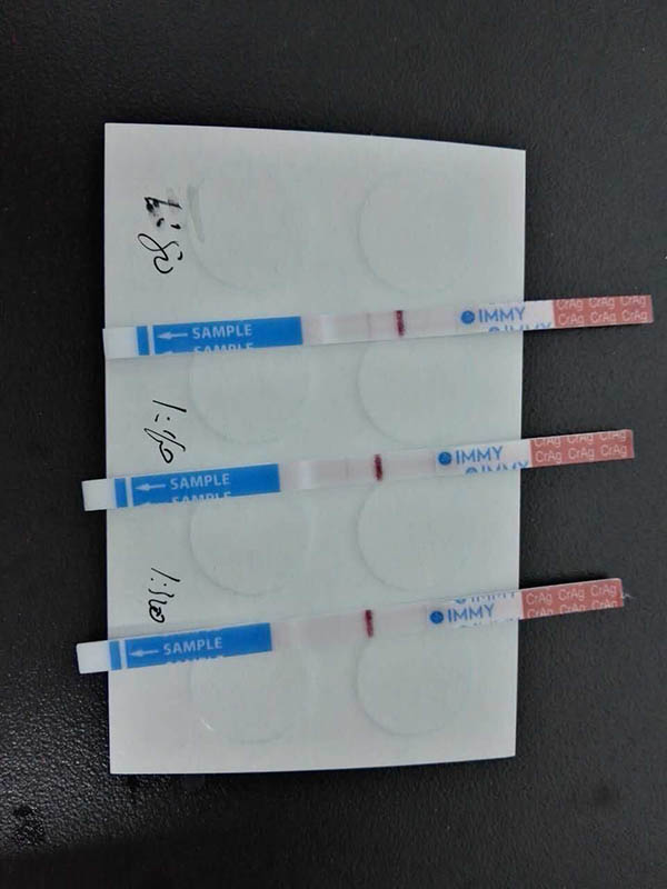 Cryptococcal Antigen Test4