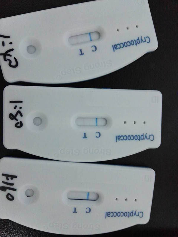 Cryptococcal Antigen Test2