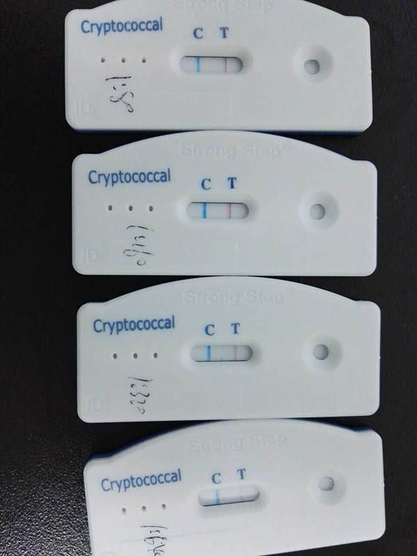 Cryptococcal Antigen Test3